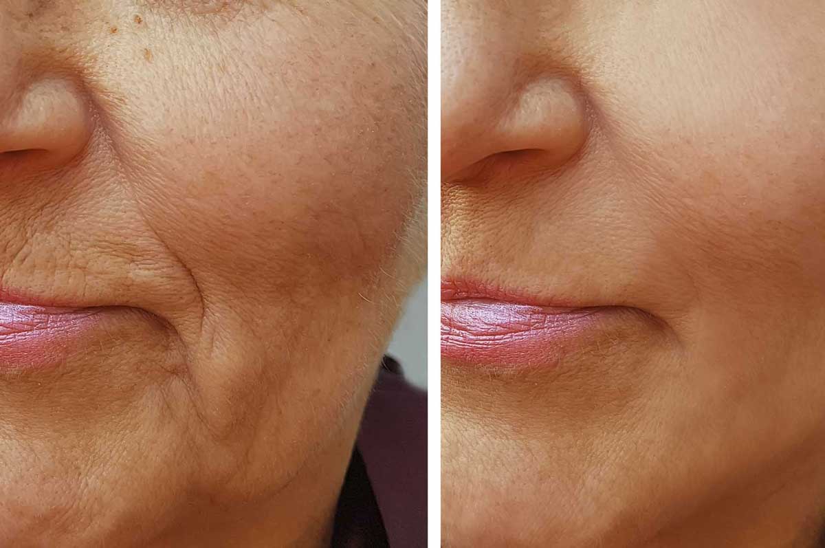 Genevieve Lecat tenseurs Montigny le Bretonneux